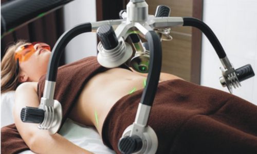 The Cost of Laser Liposuction: Understanding the Factors that Influence Pricing